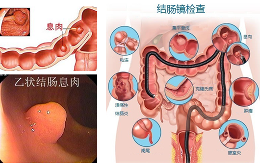 經(jīng)常放屁是在“排毒”？或許“根源”在腸道！