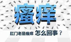 肛門瘙癢治不好嗎?先檢查病因就好辦!